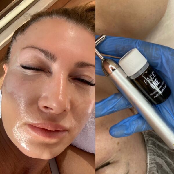 Skin Biorevitalizing peel FACE3 ONE